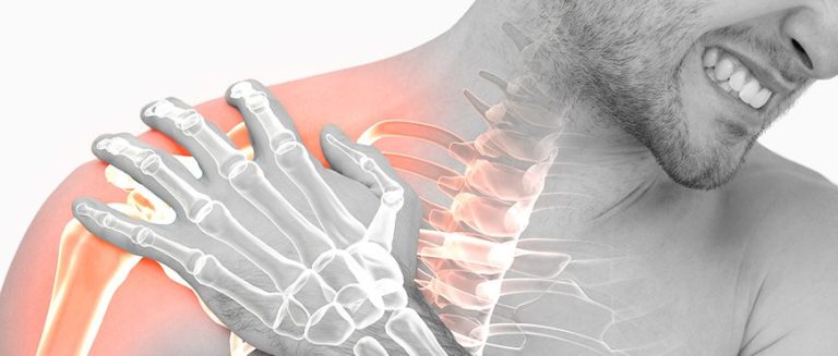 Humerus Fracture – All You Need to Know