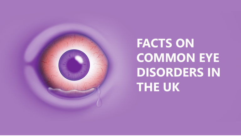 Common Eye Conditions in The UK