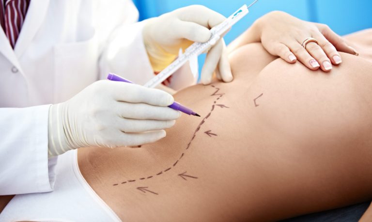 Top 5 plastic surgeries of 2020