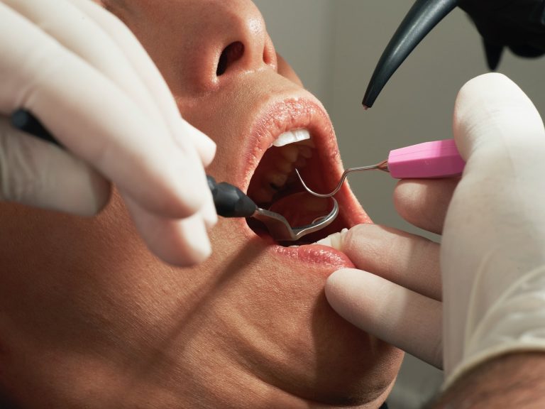 How to Stay Calm During a Dental Procedure