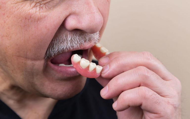 Common Reasons Why Dentures Break