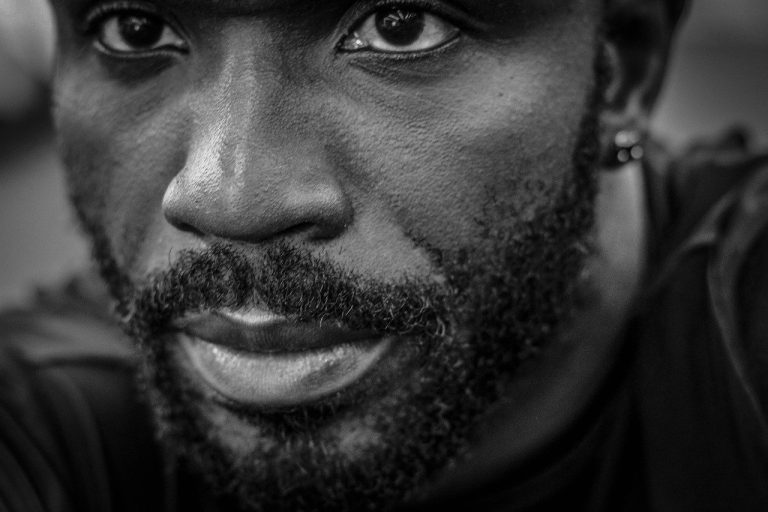 Beard Care: How To Grow And Manage Facial Hair Follicles