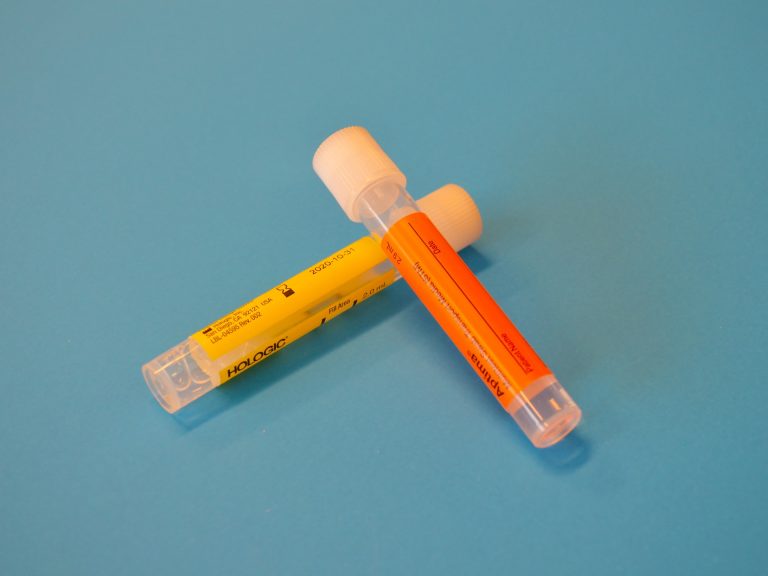 A Cholesterol Blood Test is a Must to Have!
