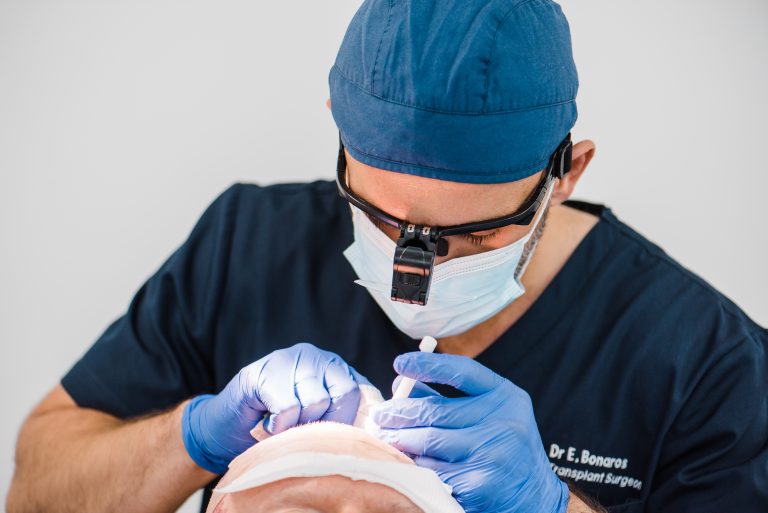 The Science Behind Hair Transplants: What to Expect from the Process