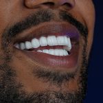 Lema Dental Clinic’s Dedication to Excellence