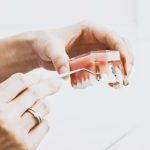 What Are the Benefits of Dental Implants Over Dentures?