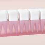 Is a White Filling better than a Silver Filling?