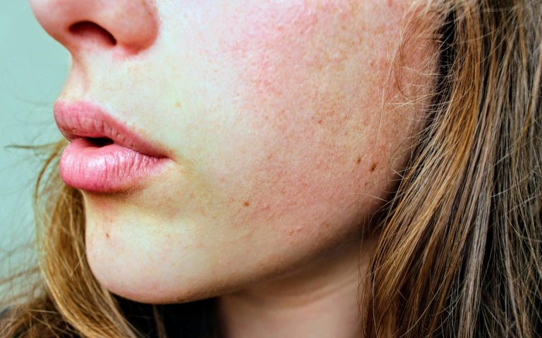 Doctor Medica Expands Aesthetic Offerings with Juvederm Ultra Smile