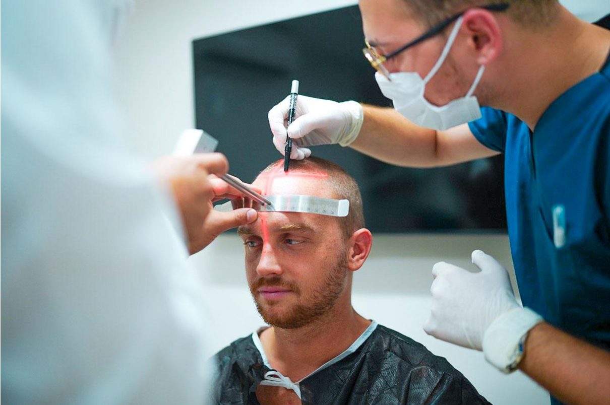 Best Hair Transplant Clinics & Doctors in Turkey (2025) – Research Report